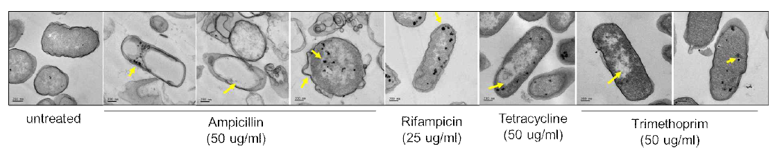 TEM micrograph in E. coli treated with antibitoics