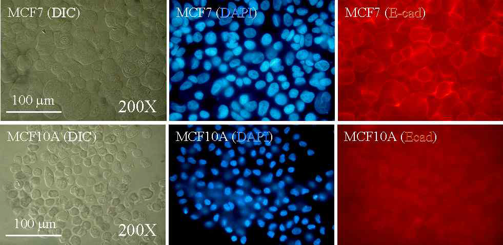 Immunocytochemcal differences of MCF7 and MCF10A cells being treated with trypsin-EDTA and susequently suspended. Cells were stained with E-cadherin antibody. E-cadherin gave totally different staining patterns in trypsin-EDTA treated cell suspension, which is different from that of MCF10A