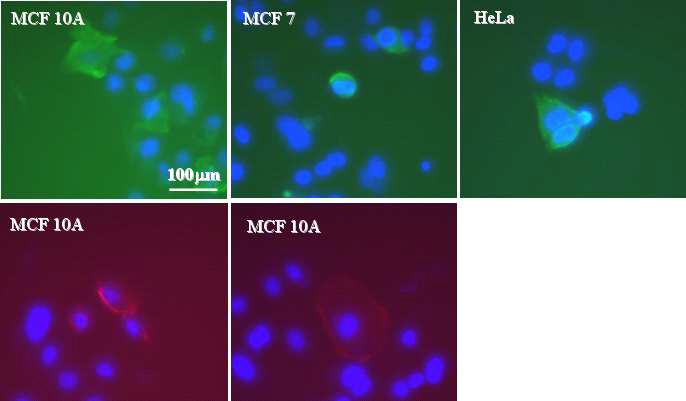 The expression of hMRLC2-GFP in various cells. hMRLC2 was highly expressed in cell membrane. hMRLC2 was expressed as asymmetric expression in membrane. Some cells showed tubular shape of hMRLC2 in cytoplasm