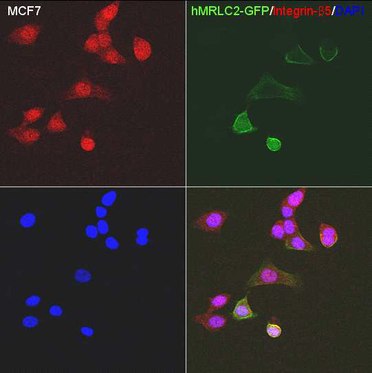 The expression of hMRLC2-GFP and integrin-β5 in MCF7. Integrin-β5 was mainly expressed in nucleus and cytoplasm. hMRLC2 and integrin-β5 were colocalized partially