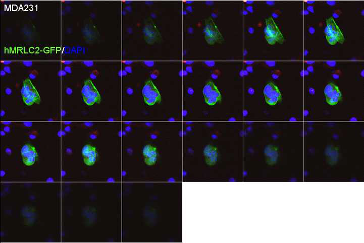 The serial expression of hMRLC2-GFP in MDA231 cells. hMRLC2 was highly expressed in tightly contact part of cells and around contact side. hMRLC2 expression pattern around contact side showed tubular shape