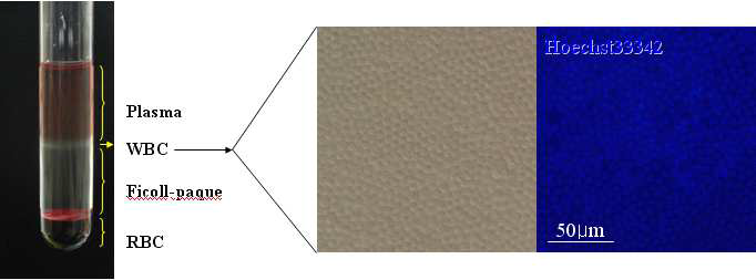 The isolation of WBC from whole blood using ficoll-paque. After centrifugation, whole blood were divided to 4 phase-plasma, WBC, ficoll and RBC. WBCs were taken by pasteur pipette. Isolated cells were stained with Hoechst33342. nearly all cells were stained by hoechst