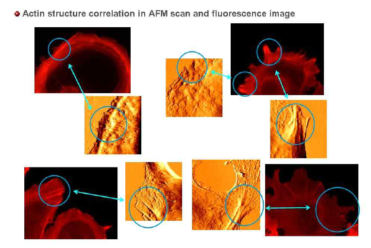 유방암 세포내 액틴 구조(붉은색)와 세포표면의 AFM 이미지(주황색)의 상응함