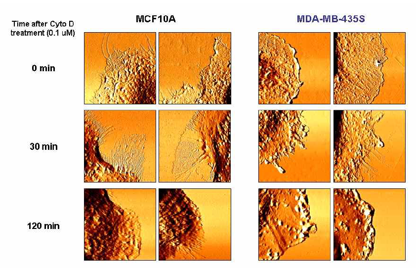 Cytochalasin D 처리 후 시간에 따른 세포경계의 변화 양상