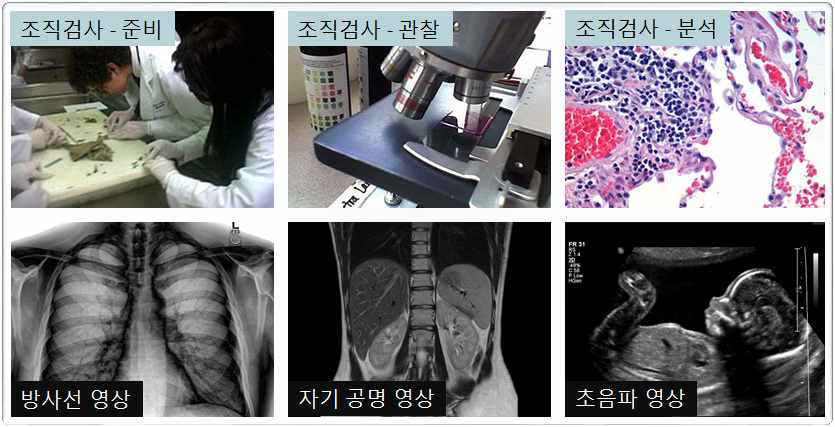 조직검사법(위)과 비(非)광학적 영상진단장비(아래)의 예