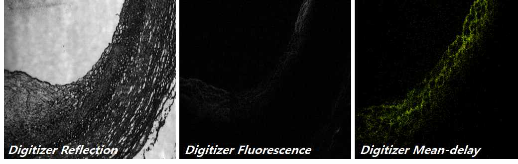 공초점 반사 현미경/근적외선 형광 현미경 및 형광수명시간 현미경 알고리즘 테스트 영상