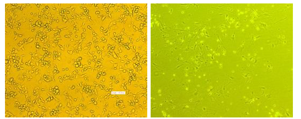 계대배양 시작 직후 종양 내 다양한 세포들이 집합 된 결과 (왼쪽)와 장기간에 걸친 계대 배양을 통해 종양세포만 특이적으로 배양 된 결과 (오른쪽)
