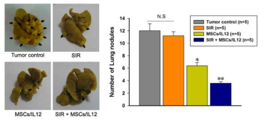 방사선 조사와 유전자 조작 MSCs/IL12의 병행 치료에 의한 폐 전이의 감소. SIR: 10 Gy single irradiation