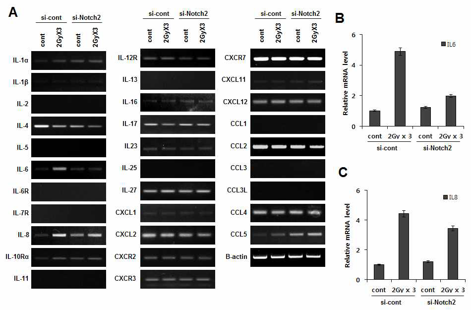 방사선 유도 Notch2 활성화에 의한 방사선 반응 분비인자 생성 조절