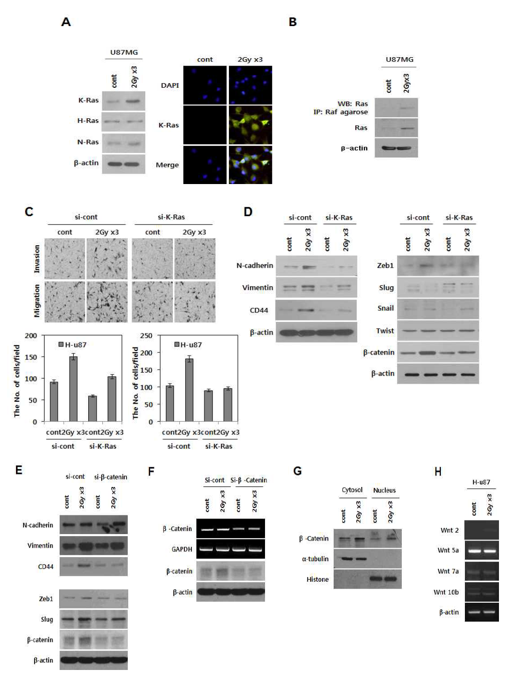 방사선 조사 후 증가하는 CD44 조절 신호기전