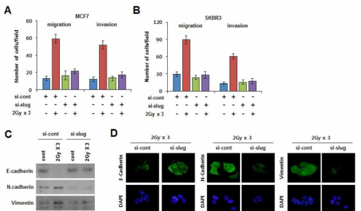 방사선 유도 Slug에 의한 암세포의 상피성-중간엽성 세포전이