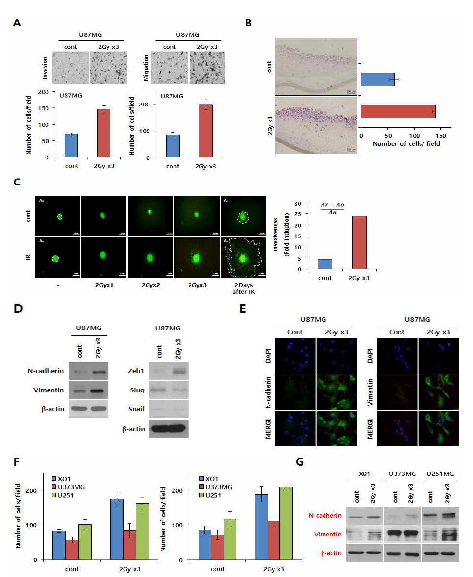 분할 방사선에 의한 glioma cell의 침투능 증가