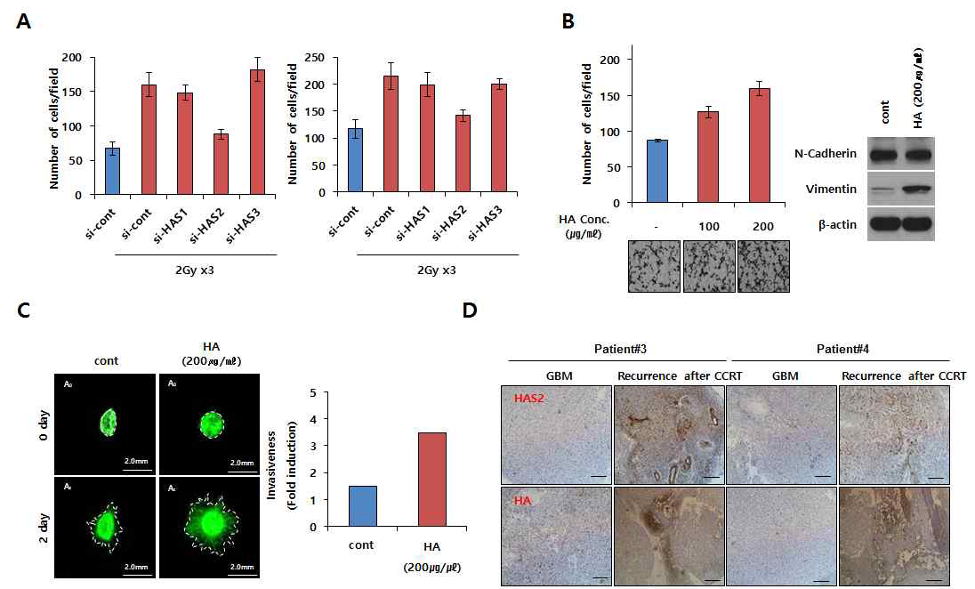 분할 방사선 조사 후 HA 분비량 증가와 glioma cells의 이동성 침윤성 증진 관련성