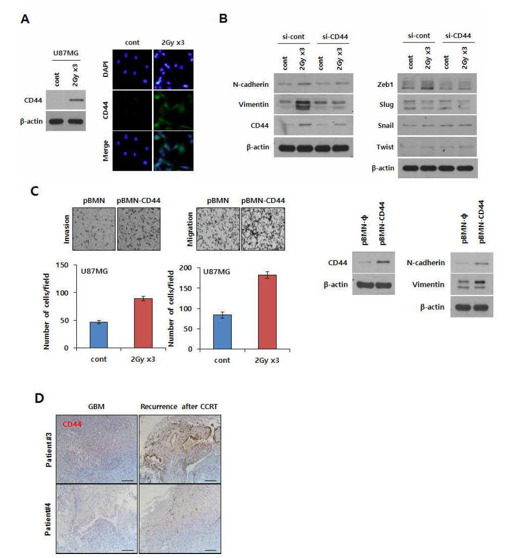 분할 방사선에 의한 HA receptor CD44 발현 증가와 이동성 침윤성 증진 관련성