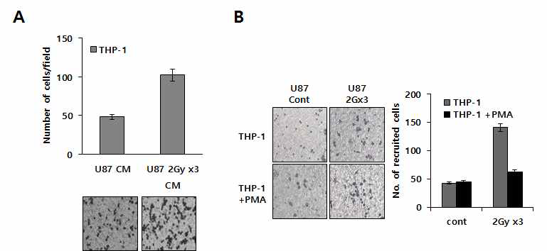 분할 방사선에 의한 Macrophage recruitment 증가