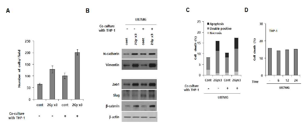 분할 방사선에 의한 Macrophage recruitment 증가와 glioma cells과의 연관성