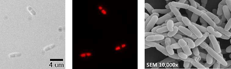 형광 현미경을 이용한 단백질 봉입체 형성 확인