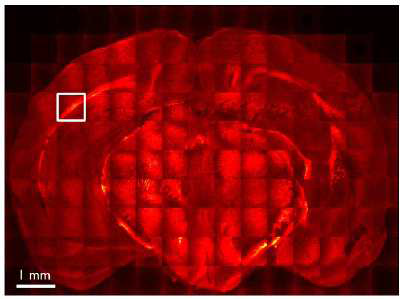 CARS microscopy로 얻은 APP and PS1AD 마우스의 뇌 이미지 (C, L. Evans et al., Optics Express)