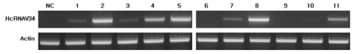 RT-PCR analysis showing the expression of HcRNAV34 VLP genes in the selected transgenic tobacco. Total RNA was extracted from leaves of transgenic tobacco, respectively. 500 ng of RNA was used in the RT-PCR analysis as template. Primer were used R34-F and R34-R. Lane NC, negative control; non-transgenic tobacco plant, Lane 1-11; transgenic tobacco plants