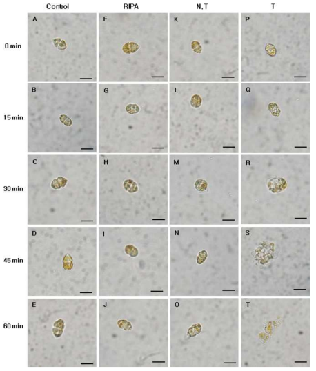 Micrographs of the algicidal process of H . circularisquama HU 9433-P treated total protein of transgenic tobacco (2.5 ㎍/㎖). Control, control group; RIPA, RIPA buffer treated group; N.T, non-transgenic tobacco protein treated group; T, transgenic tobacco protein treated group. Scale bar = 20 ㎛, all images at equal magnification (40x)