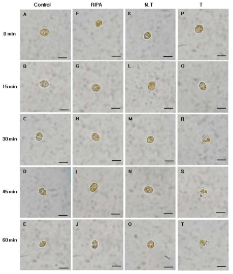 Micrographs of the algicidal process of H . circularisquama HA 92-1 treated total protein of transgenic tobacco (2.5 ㎍/㎖). Control, control group; RIPA, RIPA buffer treated group; N.T, non-transgenic tobacco protein treated group; T, transgenic tobacco protein treated group. Scale bar = 20 ㎛, all images at equal magnification (40x)