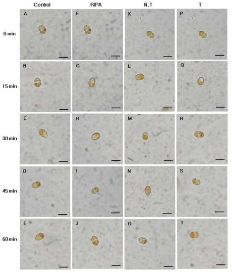 Micrographs of the algicidal process of H . circularisquama HU 9423 treated total protein of transgenic tobacco (2.5 ㎍/㎖). Control, control group; RIPA, RIPA buffer treated group; N.T, non-transgenic tobacco protein treated group; T, transgenic tobacco protein treated group. Scale bar = 20 ㎛, all images at equal magnification (40x)