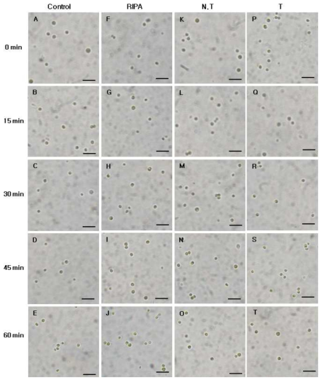 Micrographs of the algicidal process of C. vulgaris treated total protein of transgenic tobacco (2.5 ㎍/㎖). Control, control group; RIPA, RIPA buffer treated group; N.T, non-transgenic tobacco protein treated group; T, transgenic tobacco protein treated group. Scale bar = 10 ㎛, all images at equal magnification (40x)