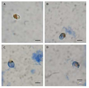 Light microscopic observation of H . circularisquama HU 9433-P, treated total protein of transgenic tobacco plant. (A) normal; (B) Cell cytoplasm becoming stained after 15 min; (C) release of cellular component after 30 min; (D) destruction of cell contents and broken thecae treated 45 min. Scale bar = 20 ㎛, all images at equal magnification (40x)