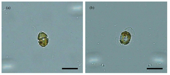 Light microscopic observation of Heterocapsa circularisquama in cultures with the absence (a) and presence of algicidal substance (b). Scale bar: 50 μm