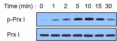 NIH3T3 세포에서 성장인자 자극에 의한 Prx I의 인산화