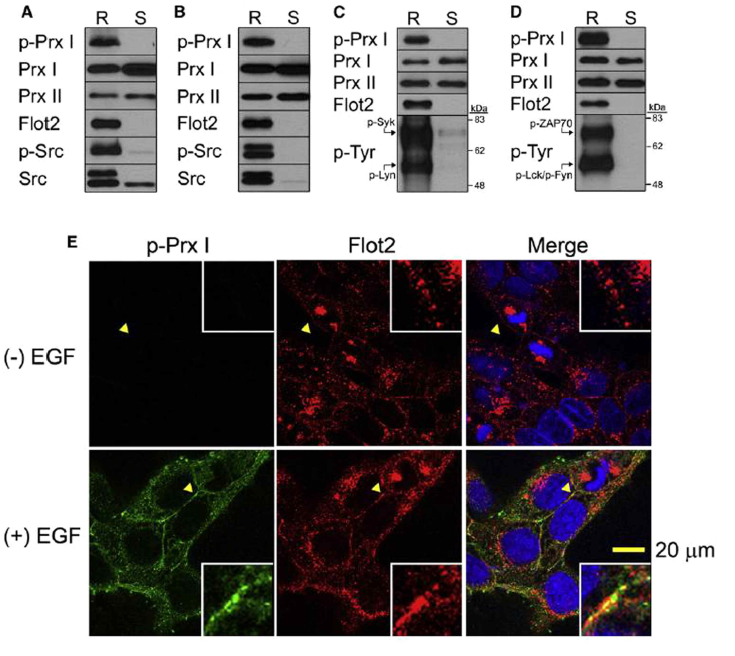 Lipid rafts에서의 Prx I의 인산화