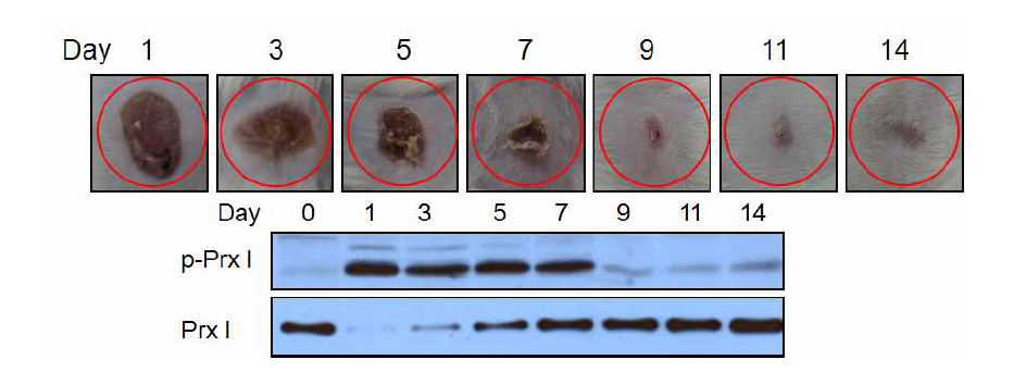 마우스에서 피부 상처 회복 중의 Prx I의 인산화. Balb/c 마우스의 등쪽 피부에서 punch를 사용해서 6 mm 크기의 상처를 낸 후, 회복되는 과정 중에 해당 날짜에서 일정한 크기로 피부를 취해 Prx I 단백질의 발현 정도와 인산화를 확인하였다