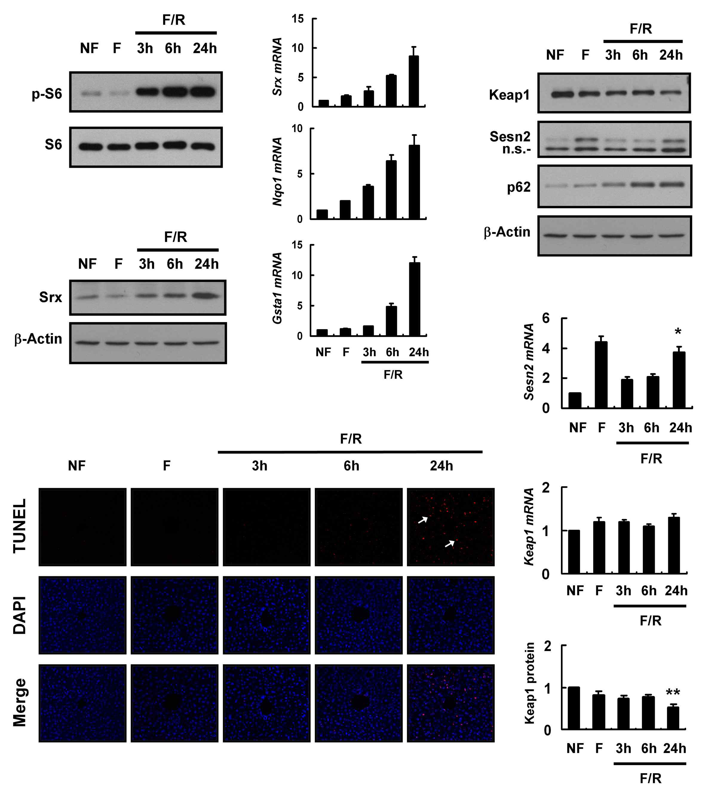 Nrf2 activation with inductions of Sestrin 2 and p62 by F/R in mouse liver