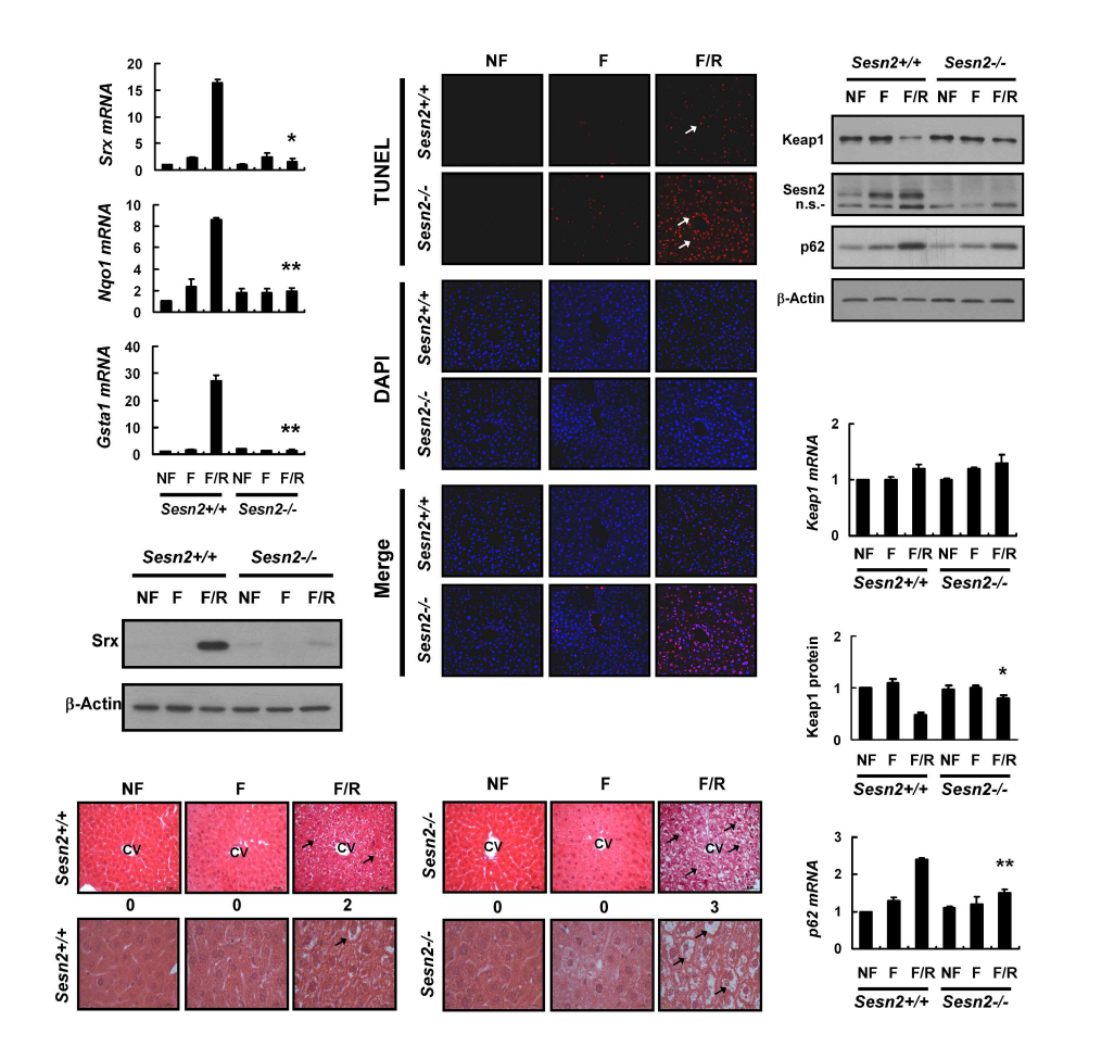 Sestrin2 protects mice against F/R-induced oxidative injury in mouse liver