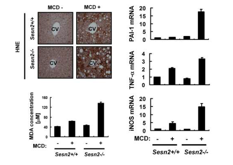 Induction of Sestrin2 during augmentation of oxidative liver injury in the murine NASH model