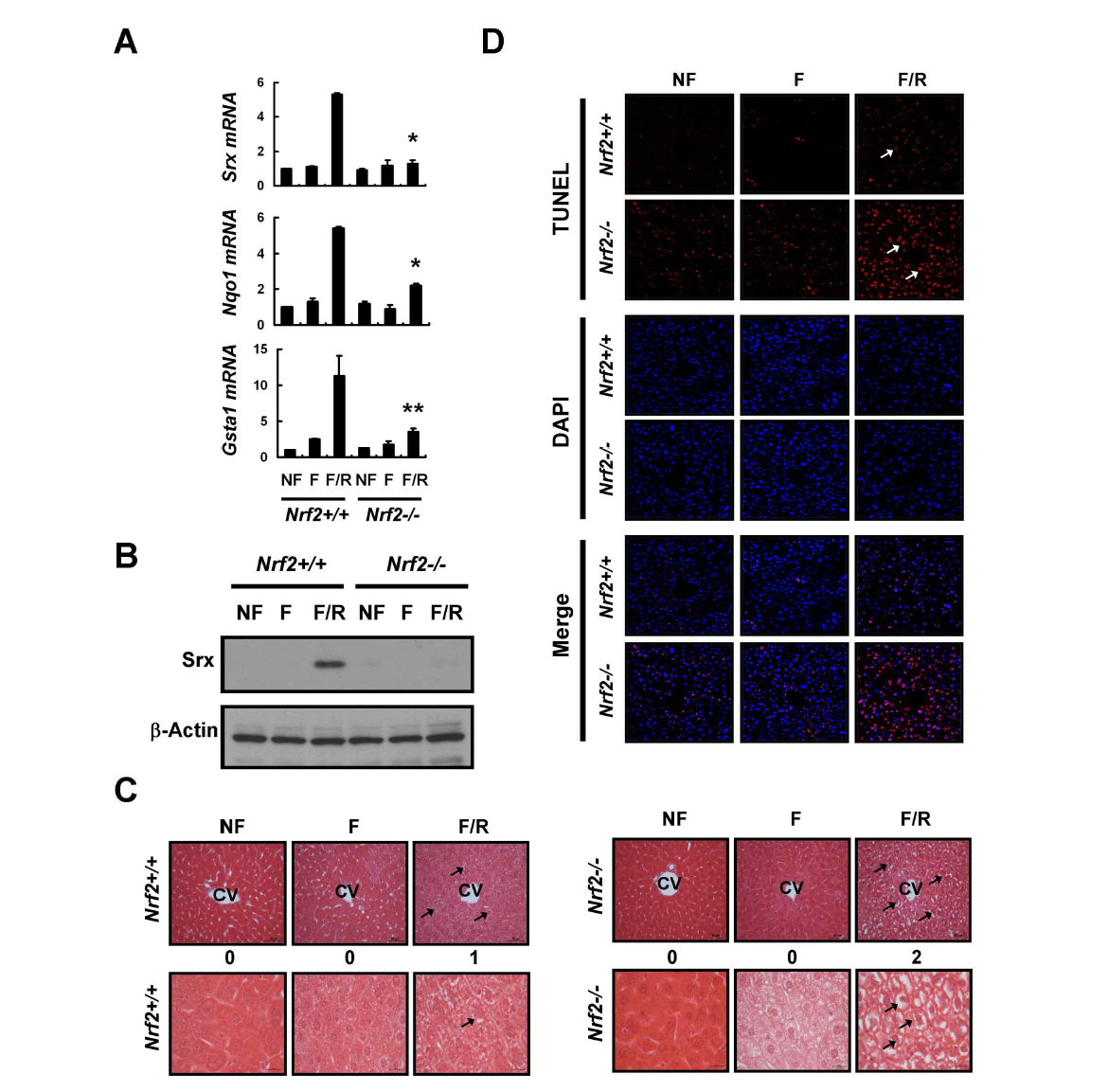 Nrf2 protects apoptosis induced by acute hepatic steatosis