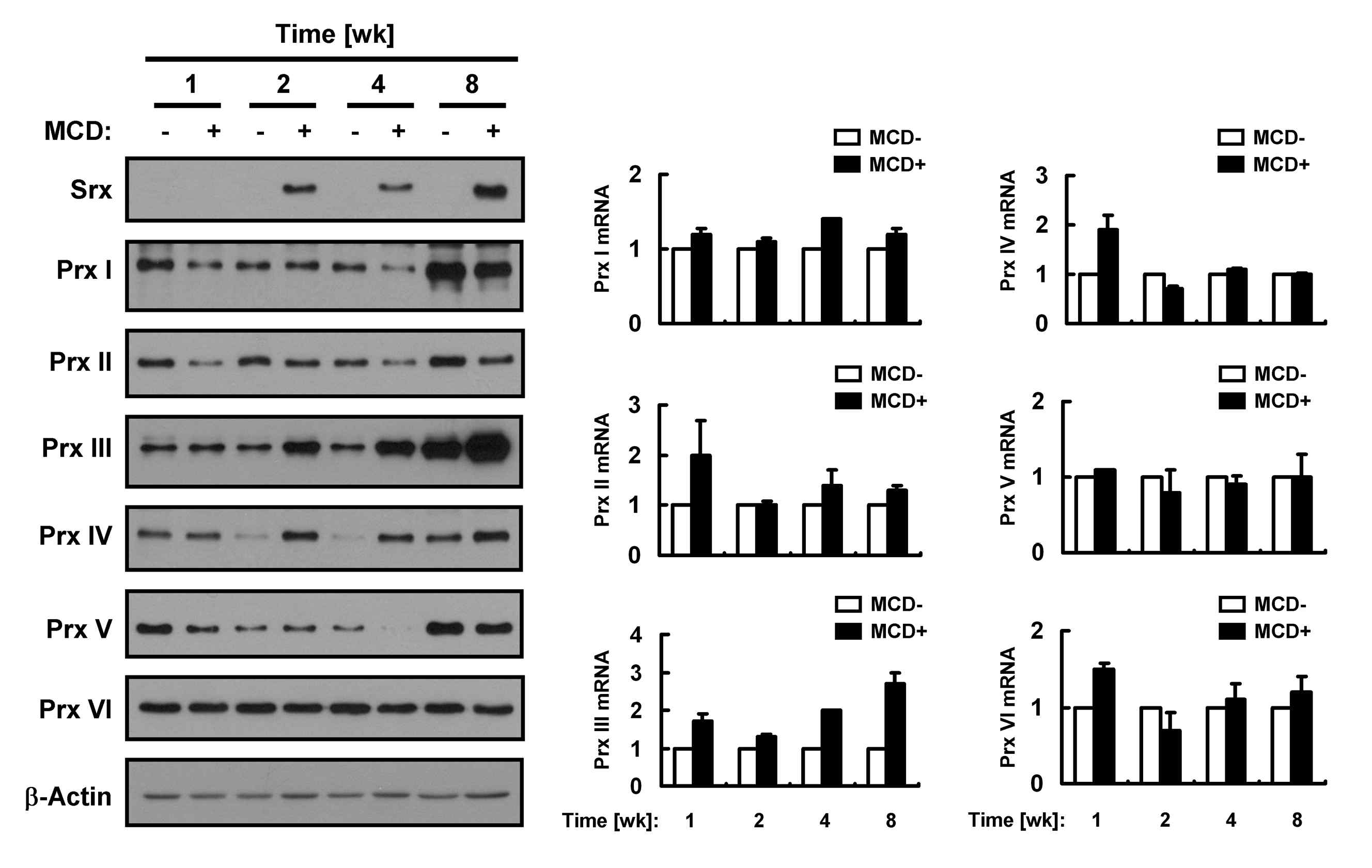 Expression pattern of antioxidant enzymes in murine NASH model