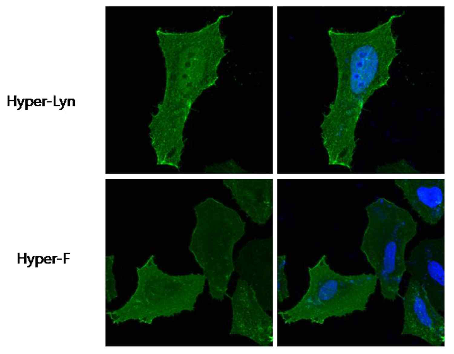 Hyper-F 또는 Hyper-Lyn을 발현시킨 세포를 anti-GFP 항체를 이용한 면역염색법으로 세포막에 위치함을 알아냄