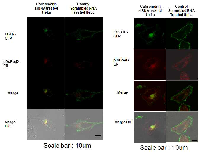 Calisomerin이 결핍된 HeLa 세포주에서 EGF receptor(좌)와 ErbB3 receptor의(우) misfolding