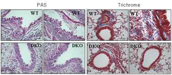 OVA에의한Gpx1/catalase DKOmice폐에서의염증유발관찰