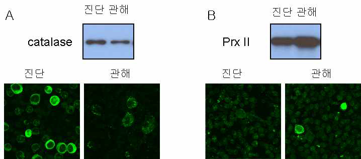 CML 환자의 진단시(진단)와 IM 처리 후 BCR-ABL 유전자가 사라진 관해 후 (관해)의 골수에서 mononuclear 세포를 분리하여 catalase (A)와 Prx II (B)로 immunoblotting을 하였다 (upper panel). 또한 골수세포를 catalase (A)와 Prx II (B)의 항체를 사용하여 세포염색법을 실시하였다 (lower panel)