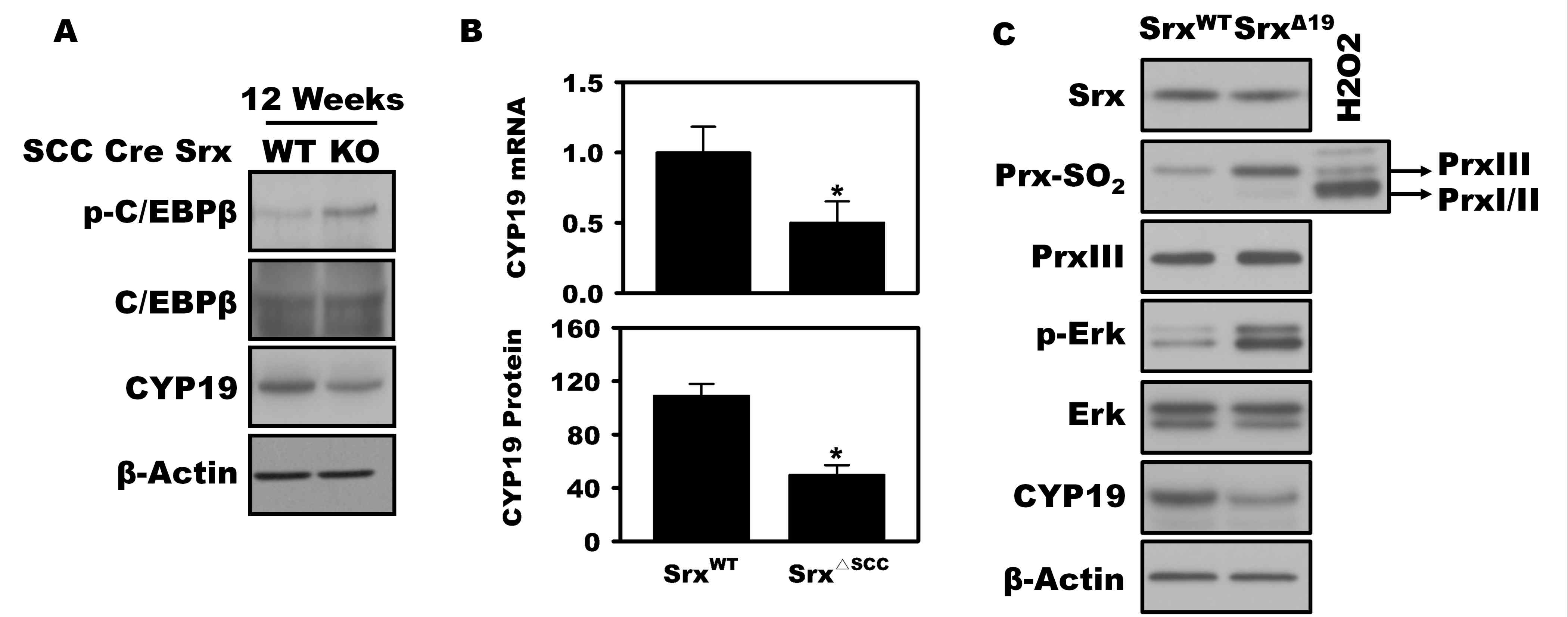 난소에서 Srx 결핍에 의한 C/EBPβ 활성도와 CYP19 발현의 변화