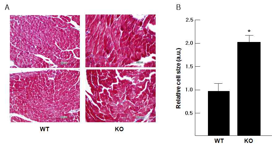 Prx III 결핍 마우스와 wild type 마우스의 좌심실의 세포 크기 비교