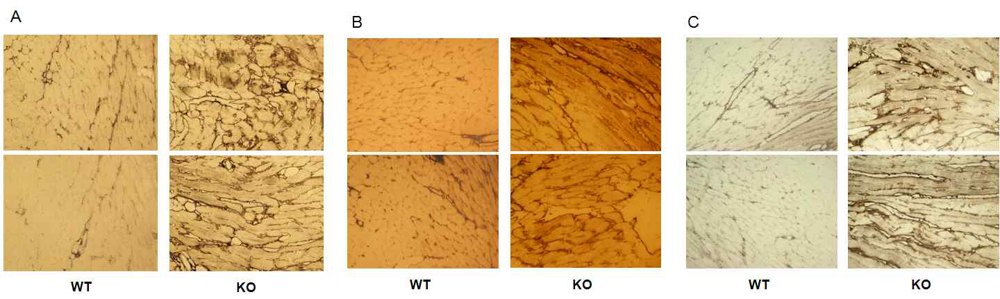 Prx III 결핍 마우스와 wild type 마우스의 심장에서 fibronectin (A), collagen type I (B), type III (C)의 발현 정도 비교