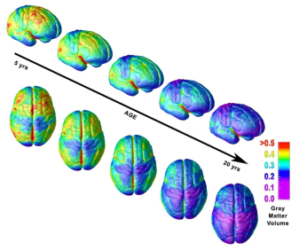 5세부터 20세까지의 뇌 피질의 발달 과정 (Gogtay 등, 2004)