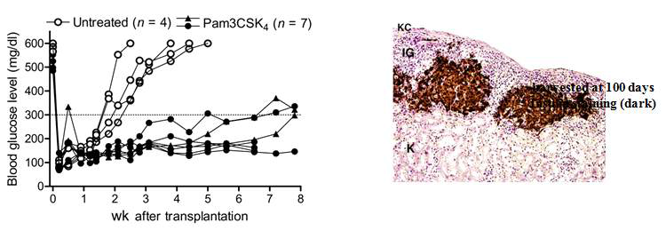 Combination of islet transplantation and Pam3Cys, a TLR2 ligand, successfully treated already eatablished type 1 diabetes of NOD mice, while islet transplantation alone induced only transient remission of diabetes and immediate recurrence of diabetes (left). Insulin immunihistochemistry shows transplanted islets were not destroyed by host autoimmnity due to tolerance established by chronic treatment with Pam3Cys (right)