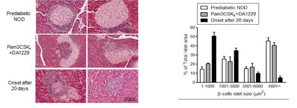 Islet histology of diabetic NOD mice treated with Pam3CSK4 in combination with DA-1229. Pancreas tissue was harvested from diabetic NOD mice after treatment with Pam3CSK4 and/or DA-1229 for 3 weeks. Islet sections were also prepared from 15-week-old female prediabetic NOD mice and diabetic NOD mice untreated for 3 weeks (left). Distribution of islet size in 15-week-old prediabetic NOD mice, diabetic NOD mice treated with Pam3CSK4+DA-1229 for 3 weeks and diabetic NOD mice untreated for 3 weeks was determined (n=3 each) (right)