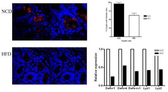 Impaired lysozyme secretion and decreased expression levels of Paneth cell specific markers