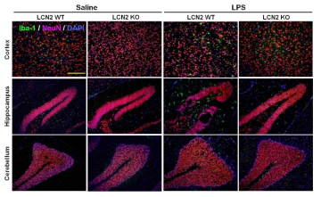 LCN2 can contribute to tissue impairment in neuroinflammation model. Brain