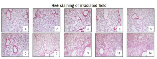 방사선에 의한 폐의 염증 반응 및 섬유화 진행 병변. 90 Gy 방사선 조사 후 3일째부터 폐 전체에 염증반응 세포들이 폐포간질, 폐포내, 기관지 주위에 침윤되며, 9일째 부터는 방사선 조사 부위로의 염증세포의 침윤이 급증하여 14일째부터는 육안으로 식별이 가능한 섬유화 병변이 나타남. 또한 방사선 조사부위의 폐포 내 대식구 및 림프구 등의 단핵구와 단백양 물질이 증가함. hematoxylin & eosin (H&E) staining으로 관찰